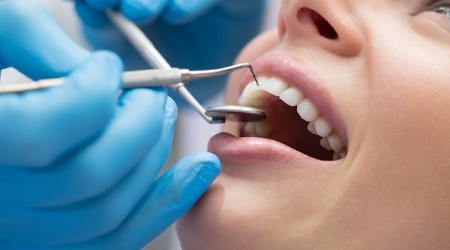 تفاصيل حول طلبات الحصول على مدفوعات برنامج رعاية الأسنان في كندا والموعد النهائي للطلبات