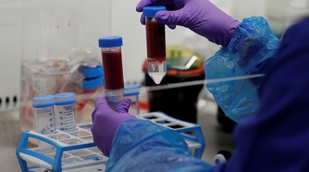 بفضل بكتريا بالإمعاء.. تقنية واعدة لإنتاج "فصيلة دم شاملة" للبشر