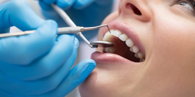 تفاصيل حول طلبات الحصول على مدفوعات برنامج رعاية الأسنان في كندا والموعد النهائي للطلبات