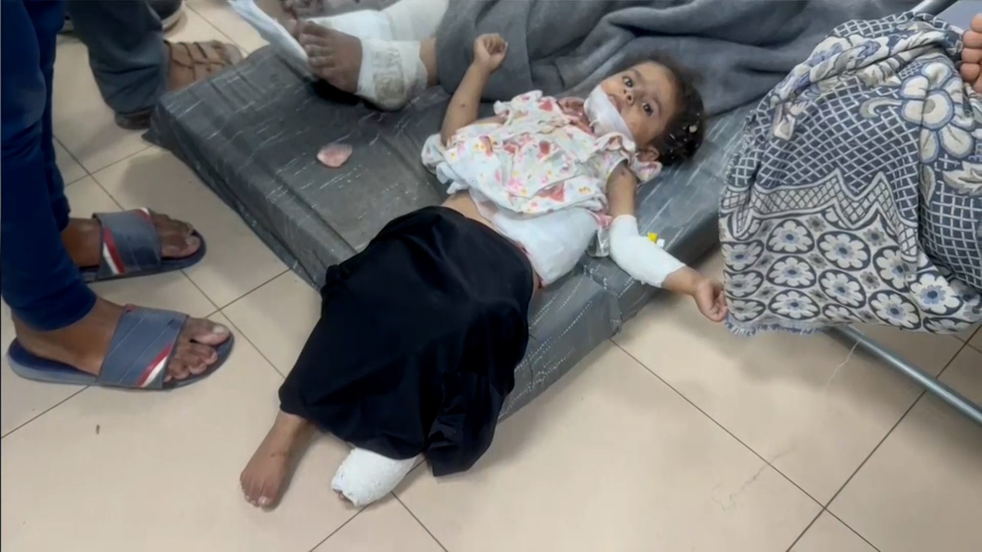 أغلبهم أطفال.. وصول مصابين للمستشفى بعد قصف منزل بمنطقة الحساينة بالنصيرات